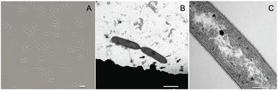 Acetate Degradation at Low pH by the Moderately Acidophilic Sulfate Reducer Acididesulfobacillus acetoxydans gen. nov. sp. nov.